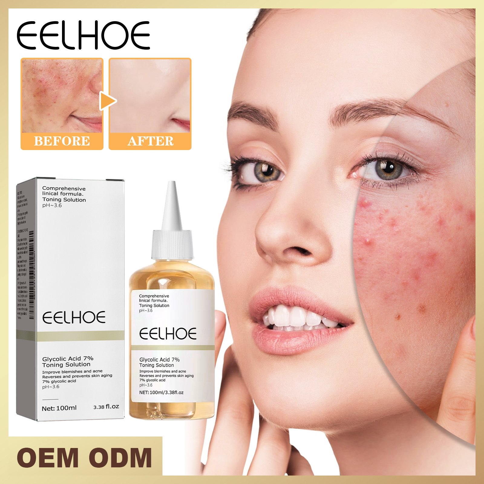 Glycolic Acid 7 Toner 1 0 0ml-box - Image 4