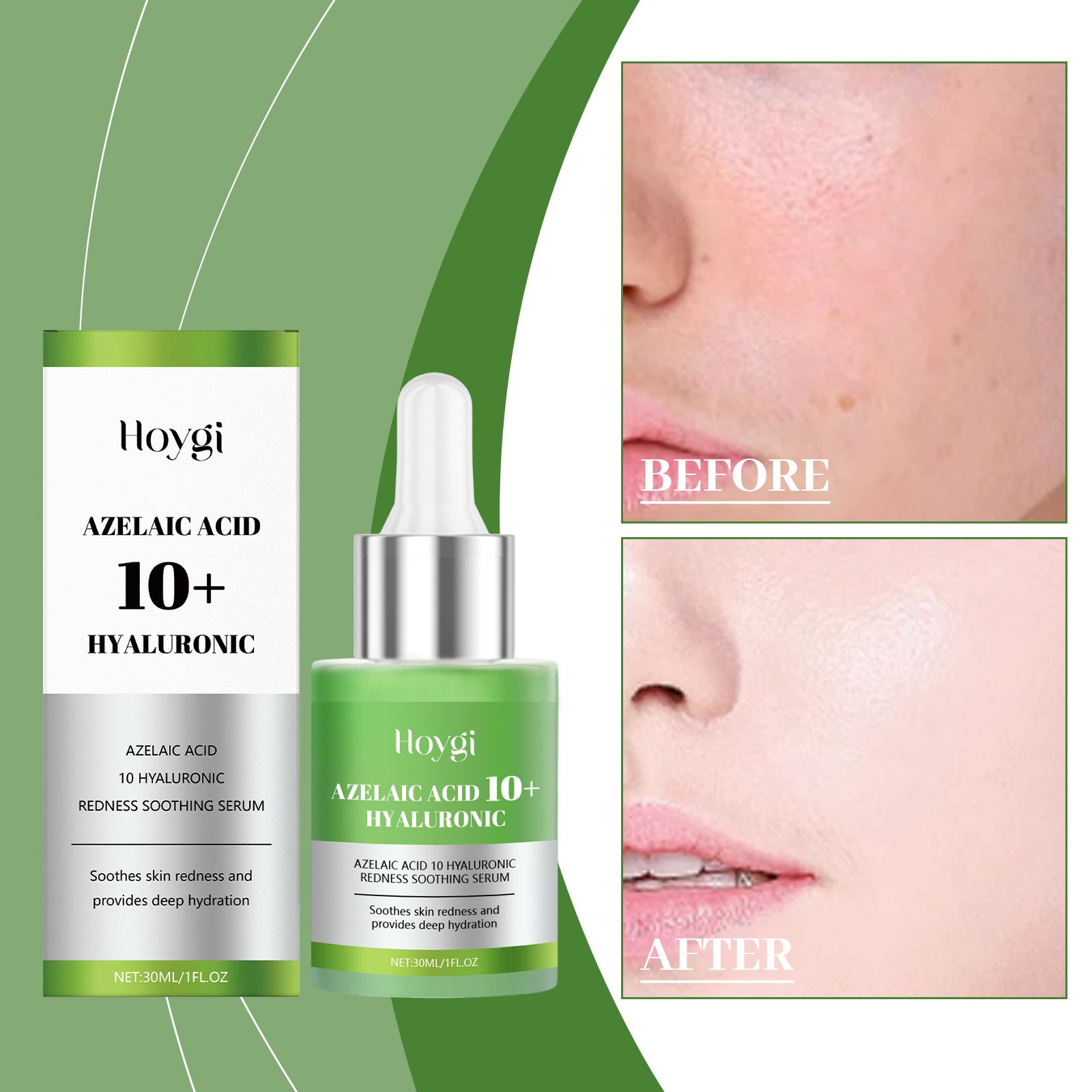 Hyaluronic Acid Soothing E Ssence Light Green 30ml-box - Image 2