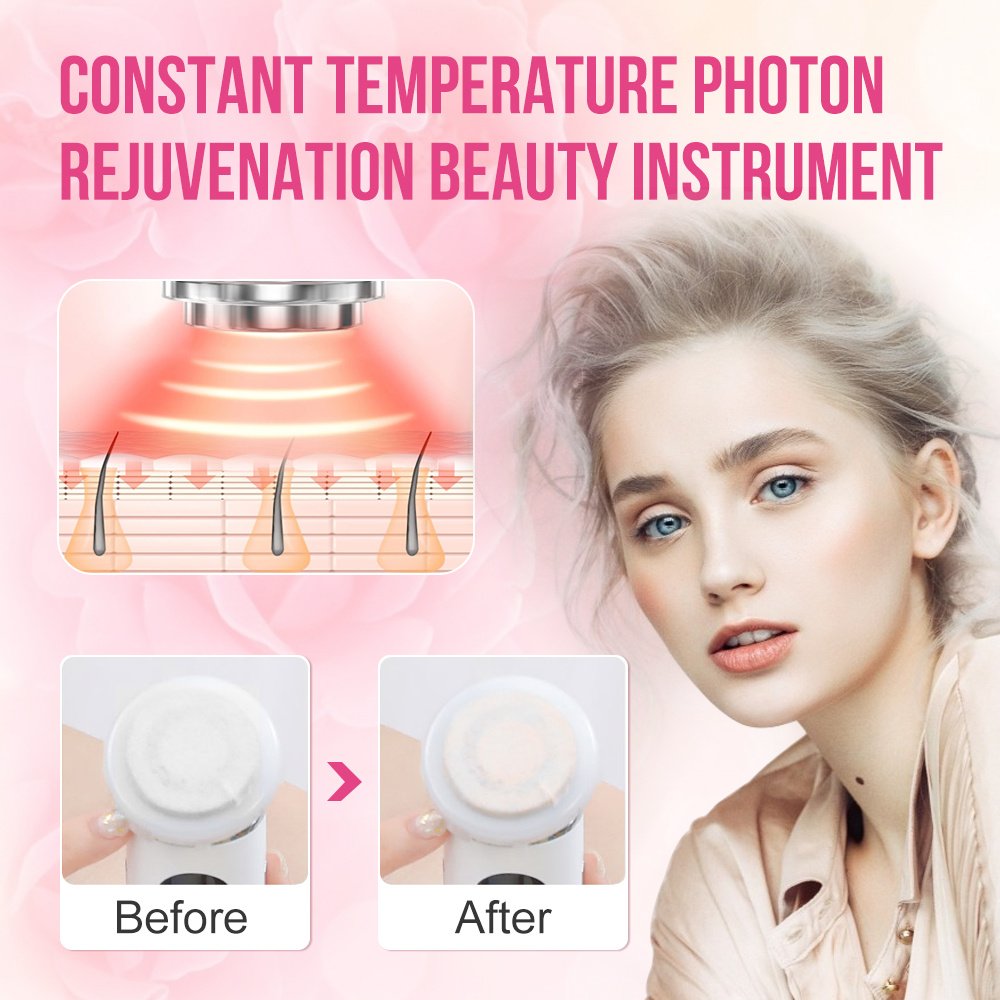 IPL Face-lifting Skin Rejuvenation Device - Image 2