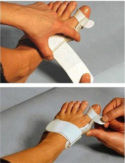 Hallux Valgus Corrector With Foot Valgus Separator - Image 6