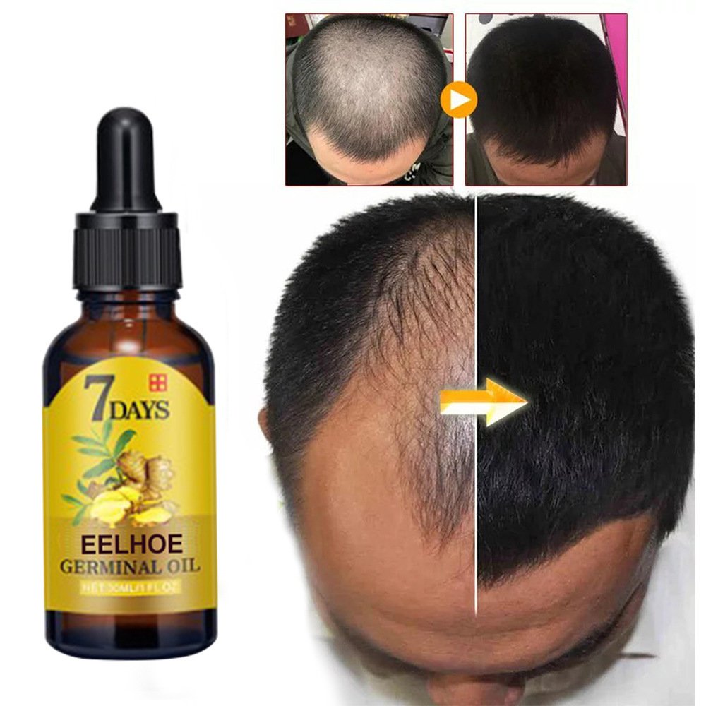 Ginger Hair Liquid 20ml 1box - Image 6