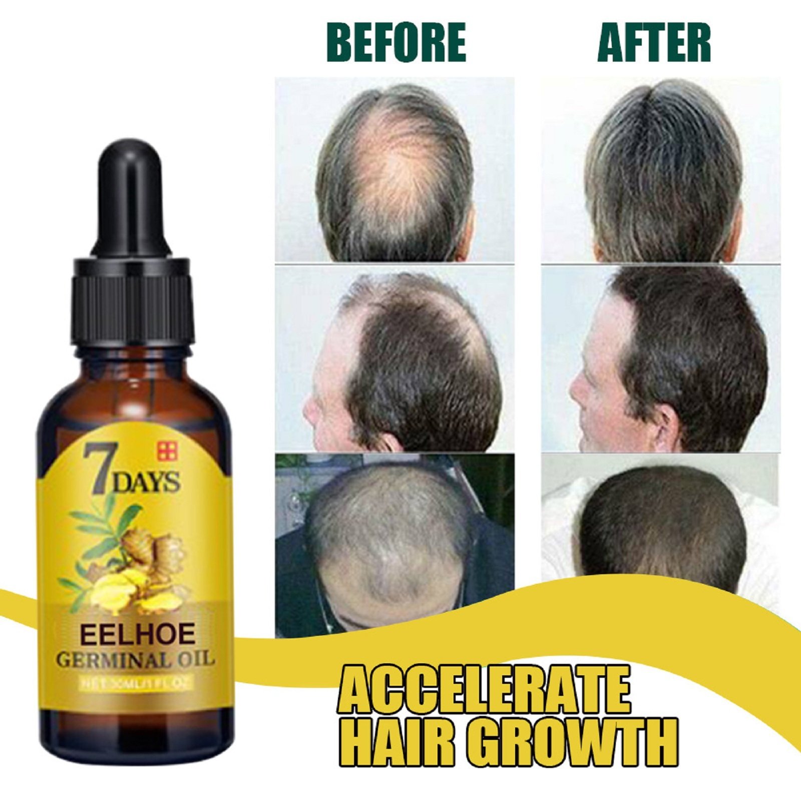 Ginger Hair Liquid 20ml 1box - Image 9