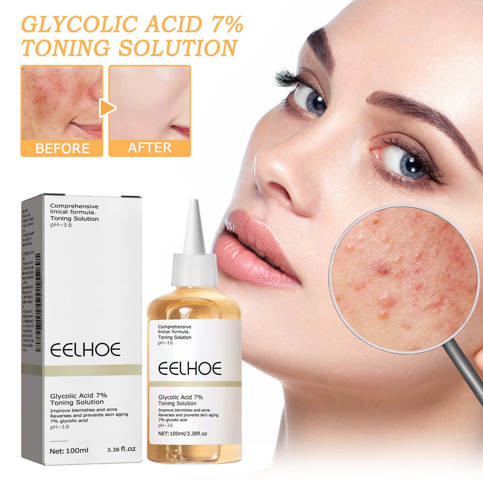 Glycolic Acid 7 Toner 1 0 0ml-box - Image 5